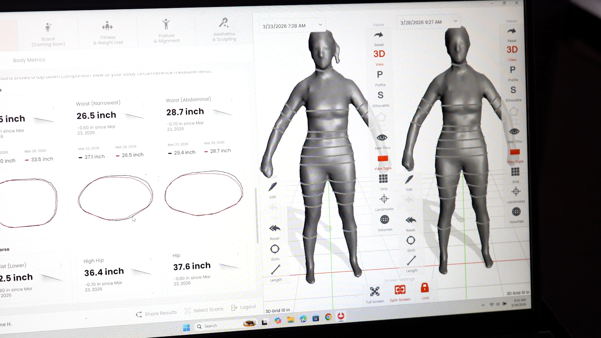 Styku 3D body scan report displayed on a computer